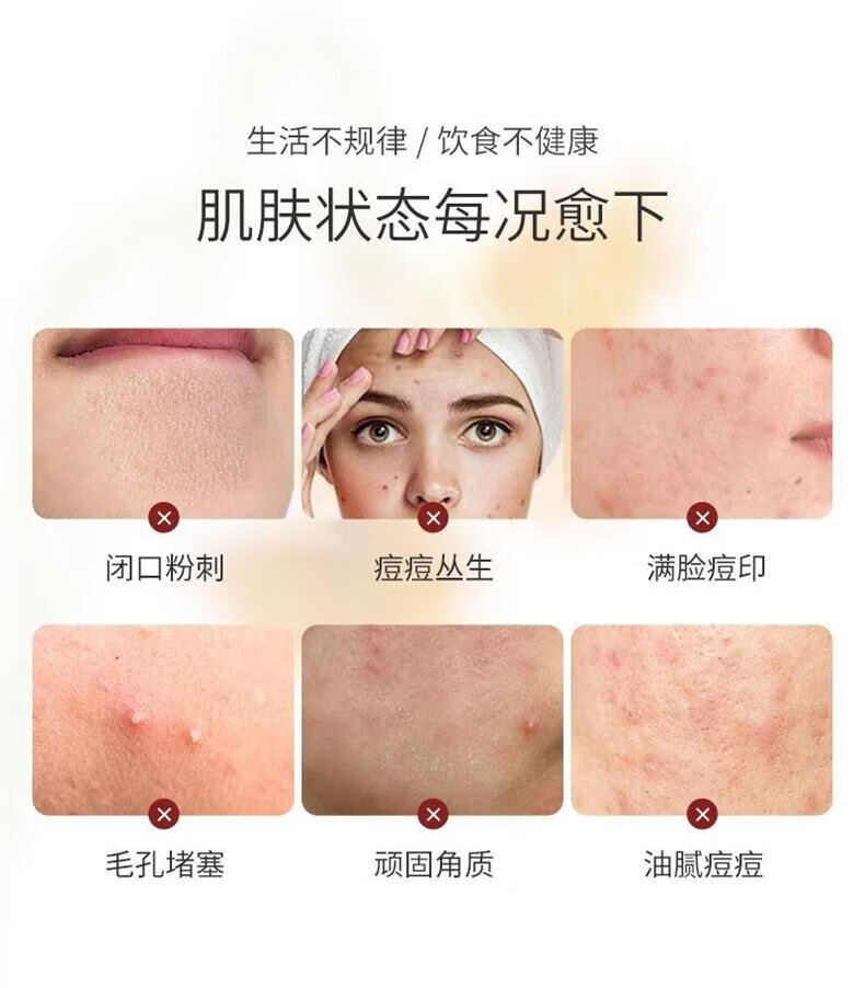 TOCITOCI6%杏仁酸焕肤精华液闭口刷果酸收缩毛孔面 一瓶30ml