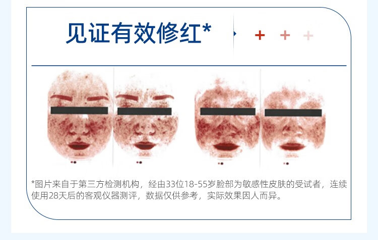 皮宝舒缓修护精华液次抛修红油橄榄精华褪红去红敏感肌 1.6ml*5