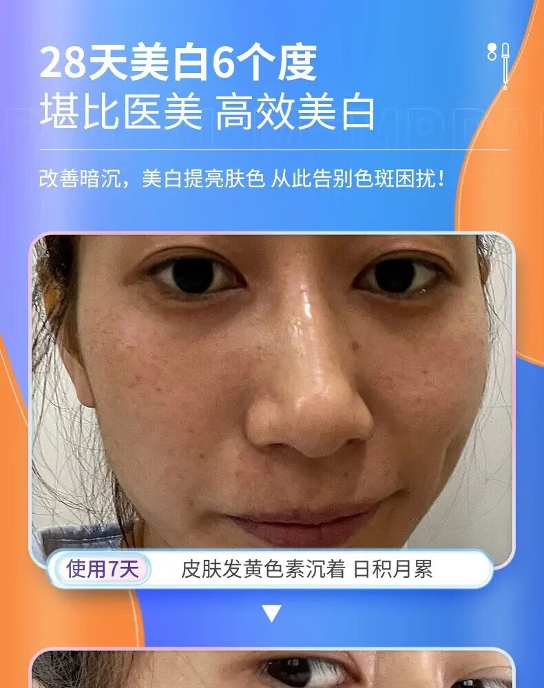韩鹭南京同仁堂美白祛斑霜淡化黑色素去雀斑黄褐斑老年斑晒斑男女可用 一瓶装 50g