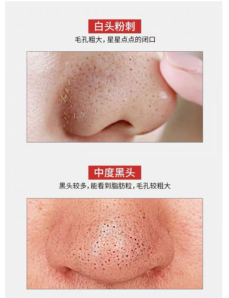 泊泉雅撕拉式吸去黑头面膜套装鼻贴毛孔收缩毛孔黑头导出液竹炭 去黑头面膜膏 60g 3盒