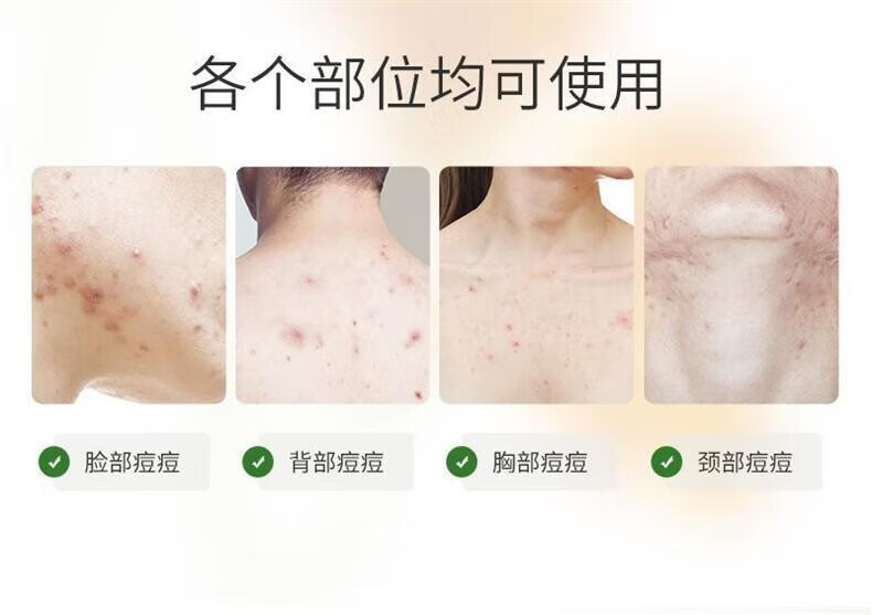 TOCITOCI6%杏仁酸焕肤精华液闭口刷果酸收缩毛孔面 一瓶30ml