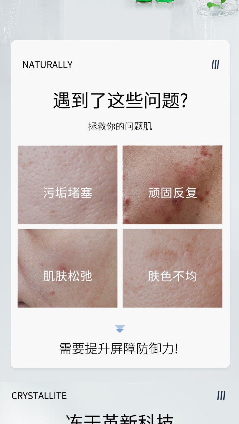 琦憶琦憶海绵微晶i针冻干套盒 小绿膜植物焕肤微晶 美容院专业用同款 一盒装海绵微晶