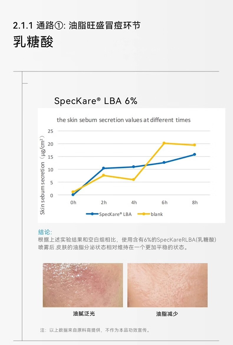 哈恩男士寡肽水乳爽肤水乳液套装补水保湿油性痘肌肤专用哈嗯 男士寡肽爽肤水+寡肽乳液