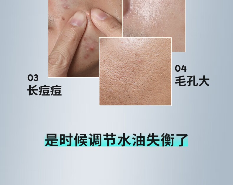 百雀羚（PECHOIN） 男士控油保湿补水爽肤水保湿补水  男士净衡保湿多效爽肤水100ml