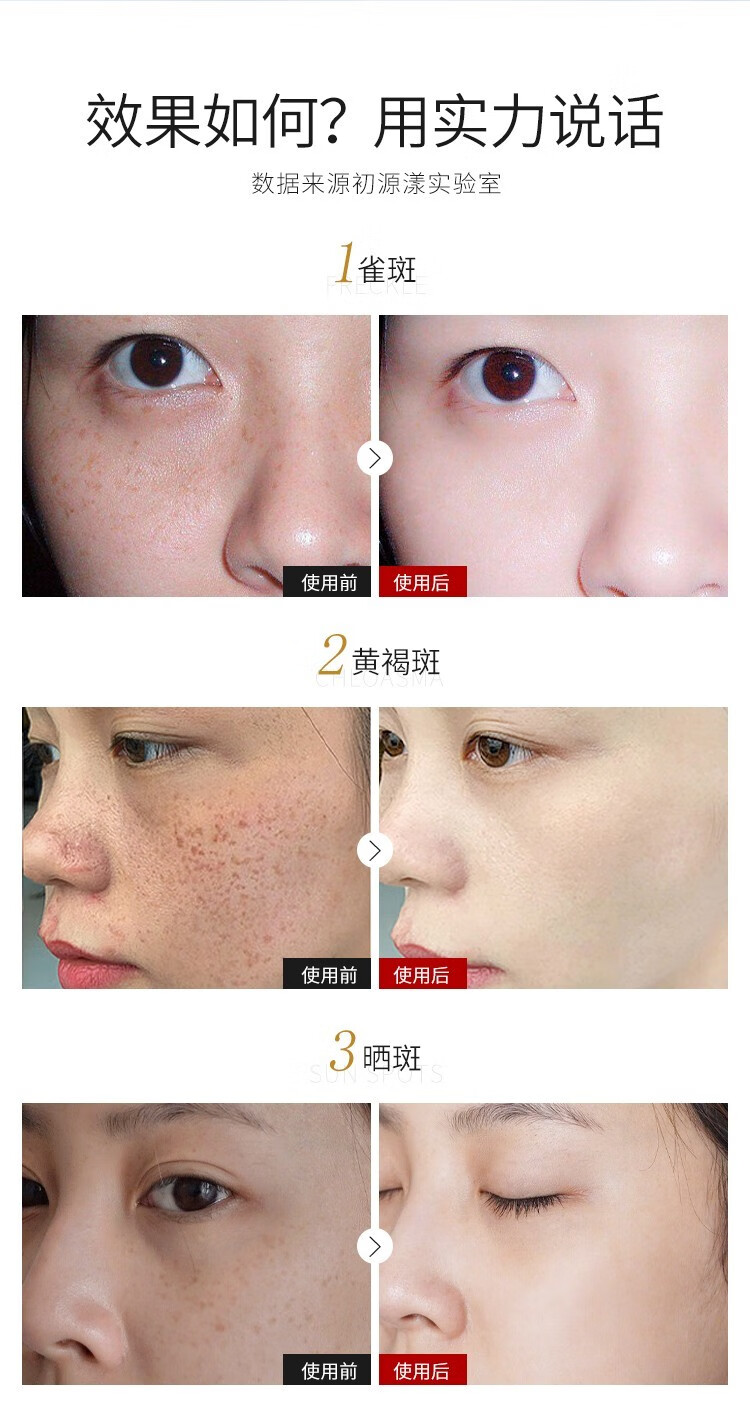 初源漾美白祛斑套装淡斑补水保湿水润修护提亮嫩肤男女通用四件套 美白祛斑套装 精华液+祛斑霜+爽肤水