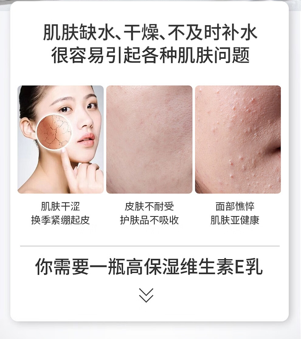 标婷北京医院研制维生素e乳液男女润肤ve乳膏保湿补水滋润肌国货护肤 标婷按压ve乳100g