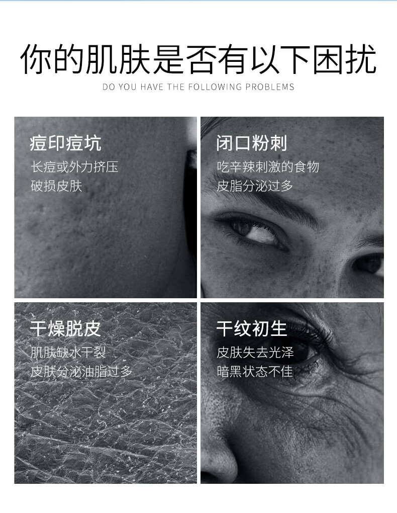 英珂 尿酸原液精华液面部补水保湿透明质酸伊缈丝收缩提亮60ml