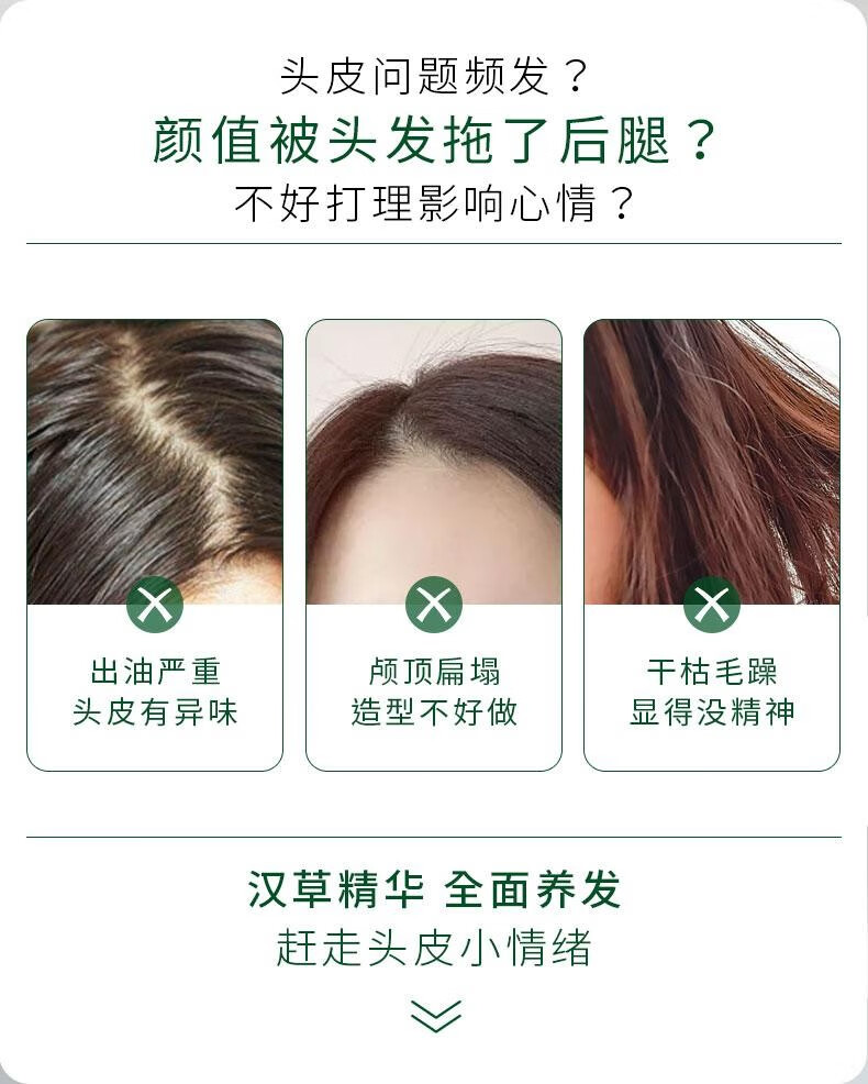 精心净痘洁面啫喱 温和控油清洁油痘青春痘 通用洁肤洗面奶 汉草精华洗发露400g