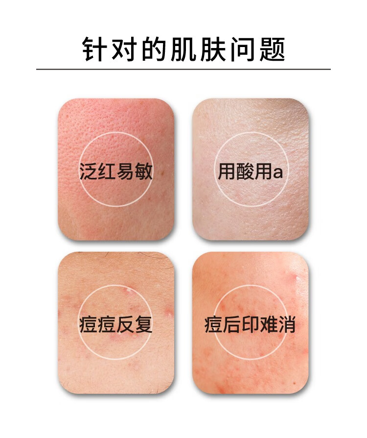 John Jeff1.325%油橄榄面部精华液控油基底精华控油舒缓肌肤温和敏感肌可用 3%b5积雪草精华50ml