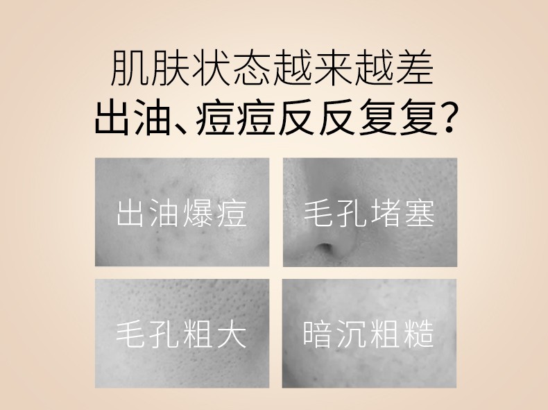 若美欣（ROMASIN） 杏仁酸祛痘亮肤精华舒缓修护精华液液果酸粉刺角质淡化痘印 祛痘杏仁酸30ml