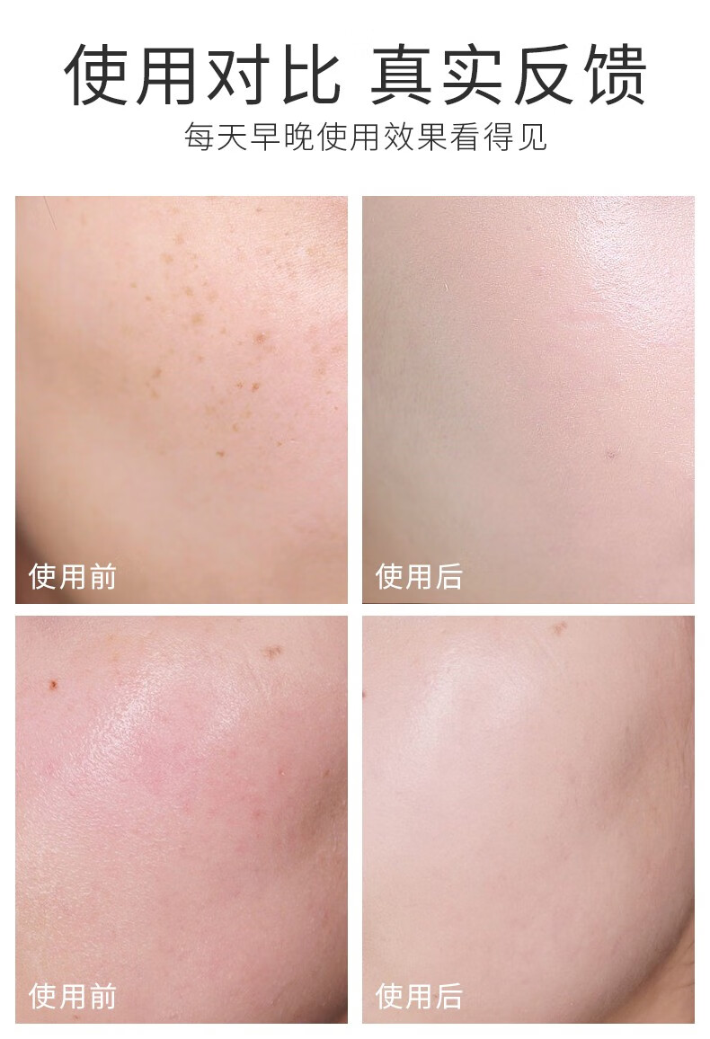 AOPY 山茶花氨基酸净透洁面乳210g（温和洗脸去大黑头去角质控油清洁毛孔男女）锁水保湿 滋养肌肤 山茶花洗面奶
