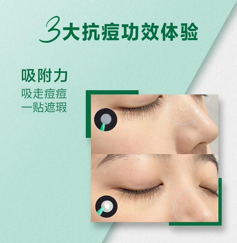 曼秀雷敦（Mentholatum） 乐肤洁隐形净痘贴抑制痘痘快速修复 净痘贴26片