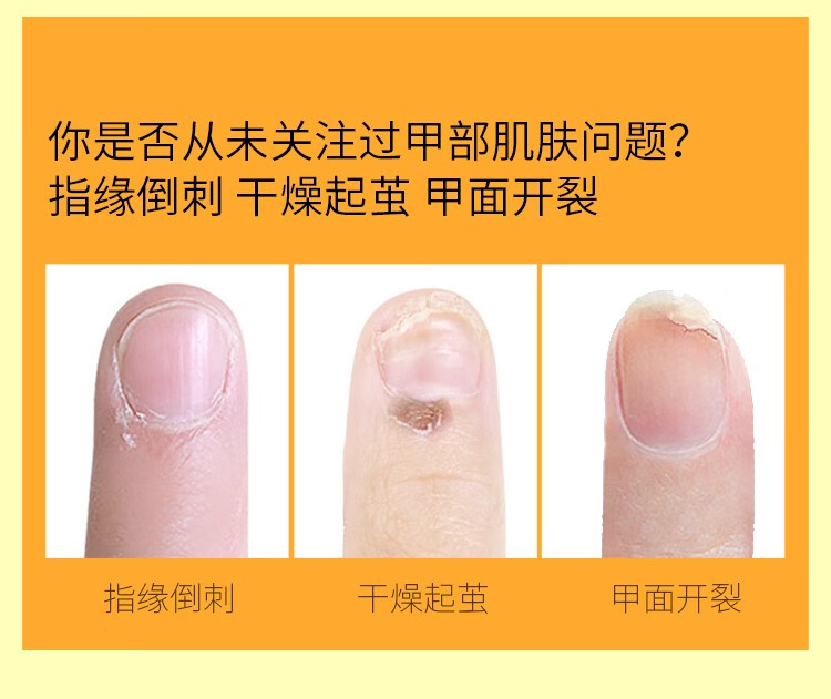 CandyMoyo膜玉香氛马油手霜黑色男士金箔护手营养指缘油护甲抚平倒刺滋养 指缘精华马油膏8g（指缘霜）