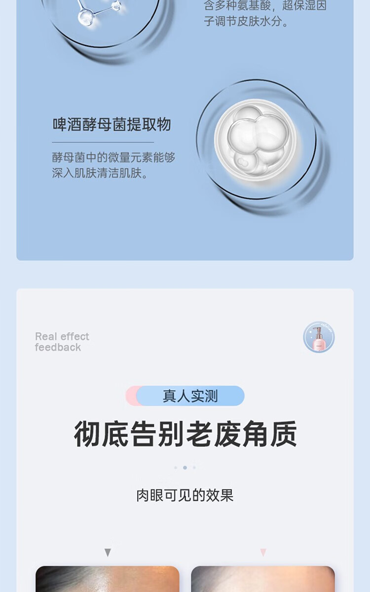 歐泉琳（LQUALYN）去角质啫喱凝胶面部磨砂去死皮男女温和全身深层清洁毛孔保湿滋养 粉红色 去角质300ml+精华液15ml