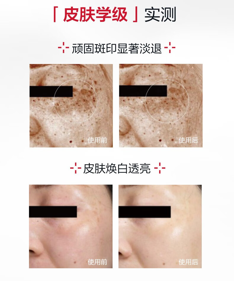 薇诺娜（WINONA）修白瓶光透皙白精华液提亮肤色淡化暗沉美白精华淡化色素沉淀修护 5ml新版