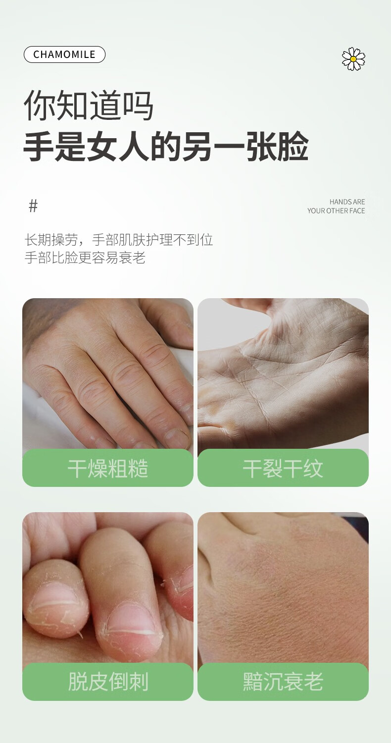 肌琳莎甘菊护手霜女大瓶防干裂滋润保湿手裂足裂夏秋冬春四季可用250g