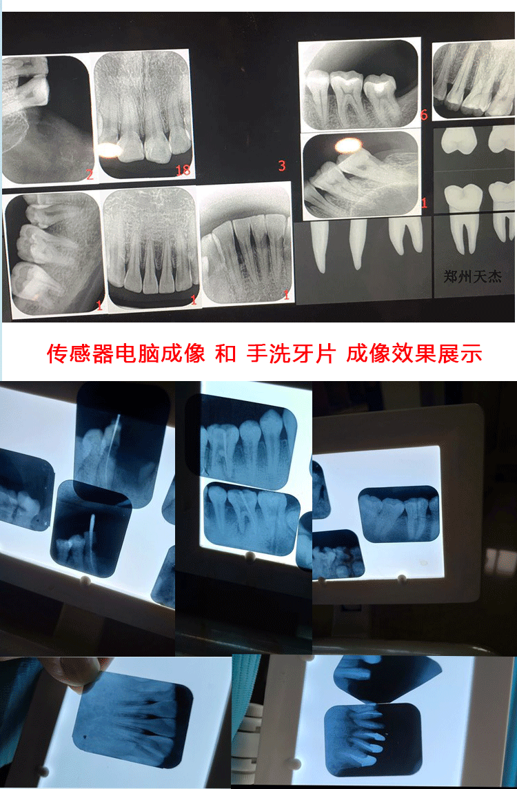 天杰牙片机x光机口腔高清高频便携式拍片机定位器传感器设备拍片机8