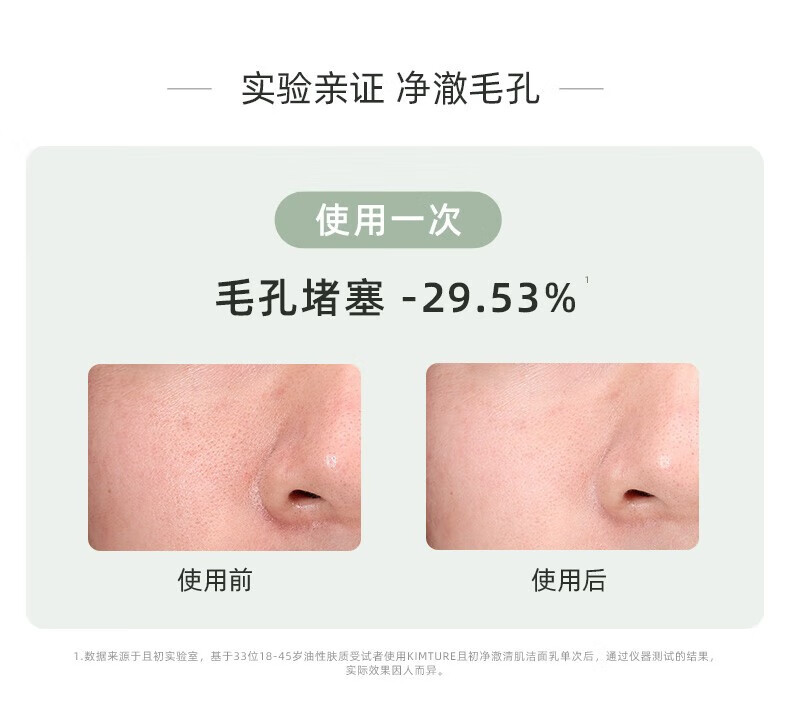 且初（KIMTRUE）洗面奶土豆泥冰淇淋氨基酸洁面温和清洁不刺激敏感肌男女通用 土豆泥洁面120g【全肤质适用】