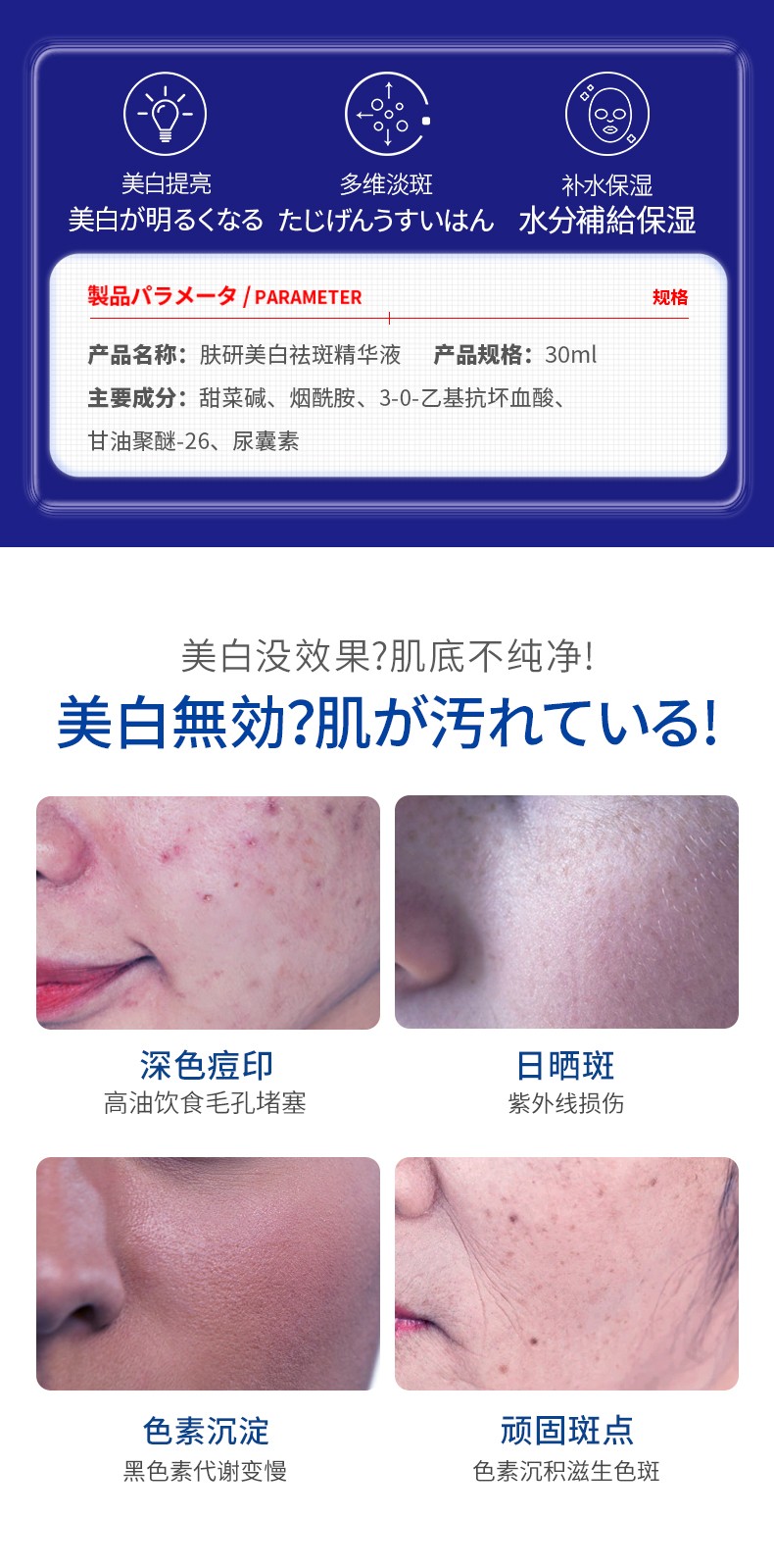 UCM肤研美白祛斑精华液提亮收缩毛孔控油女学生原液补水