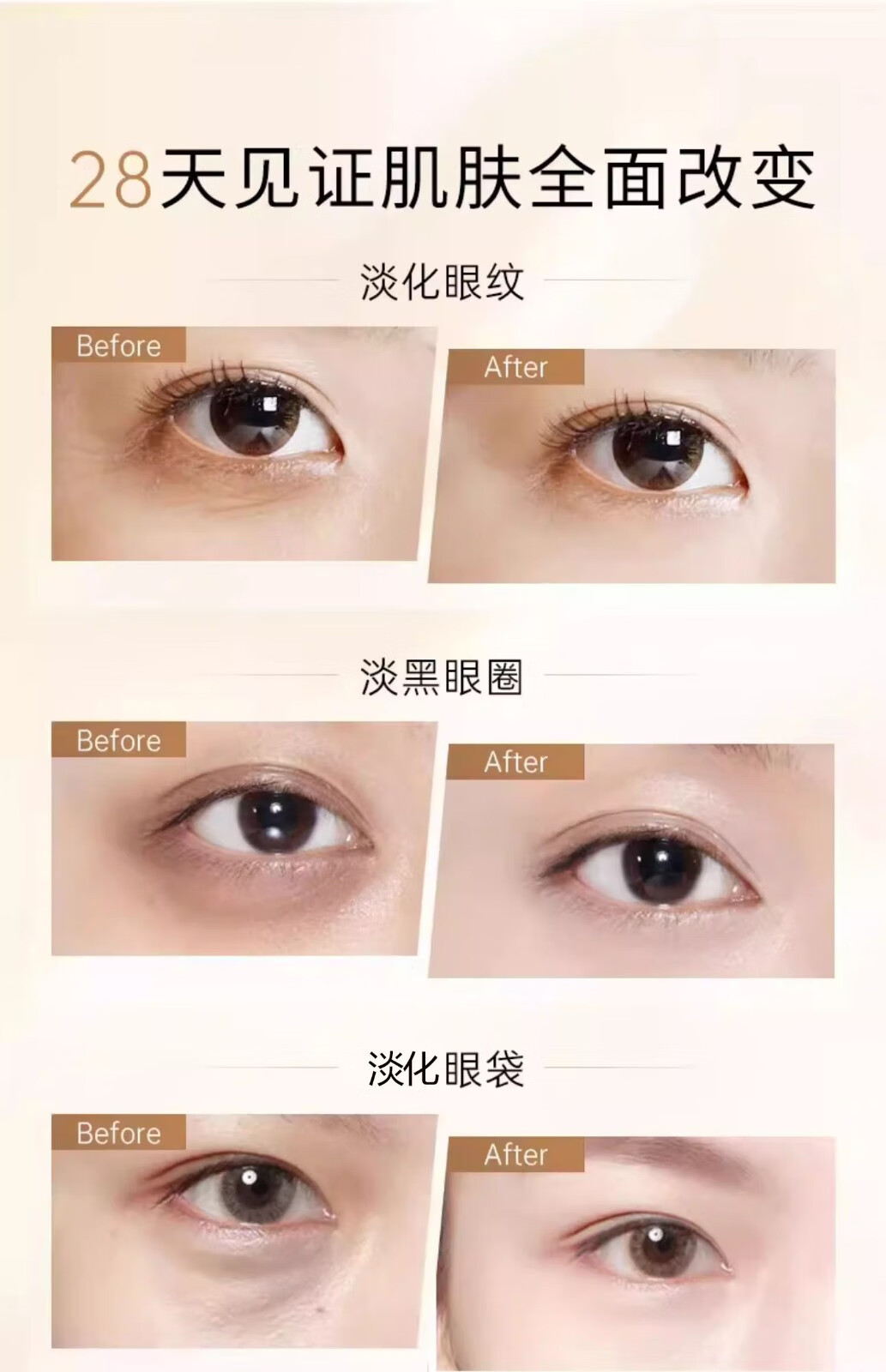 泊紫汀兰抗皱眼霜淡化细致眼纹焕亮搭提拉平复黑眼圈眼袋保湿提亮紧塑精华 30g 【单瓶装】滋润修护