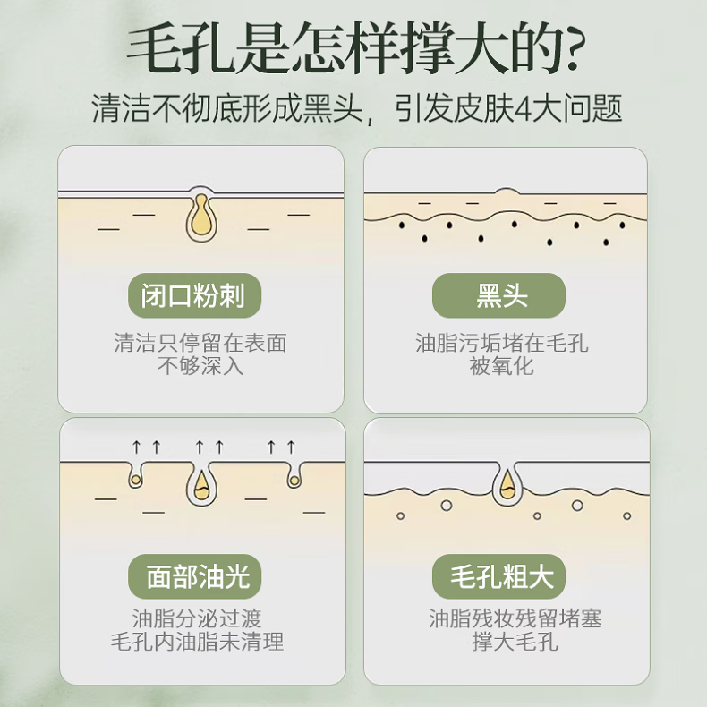 BUV叶绿素氨基酸洁面泥改善粉刺控油深层清洁毛孔洗面奶drar 1瓶装