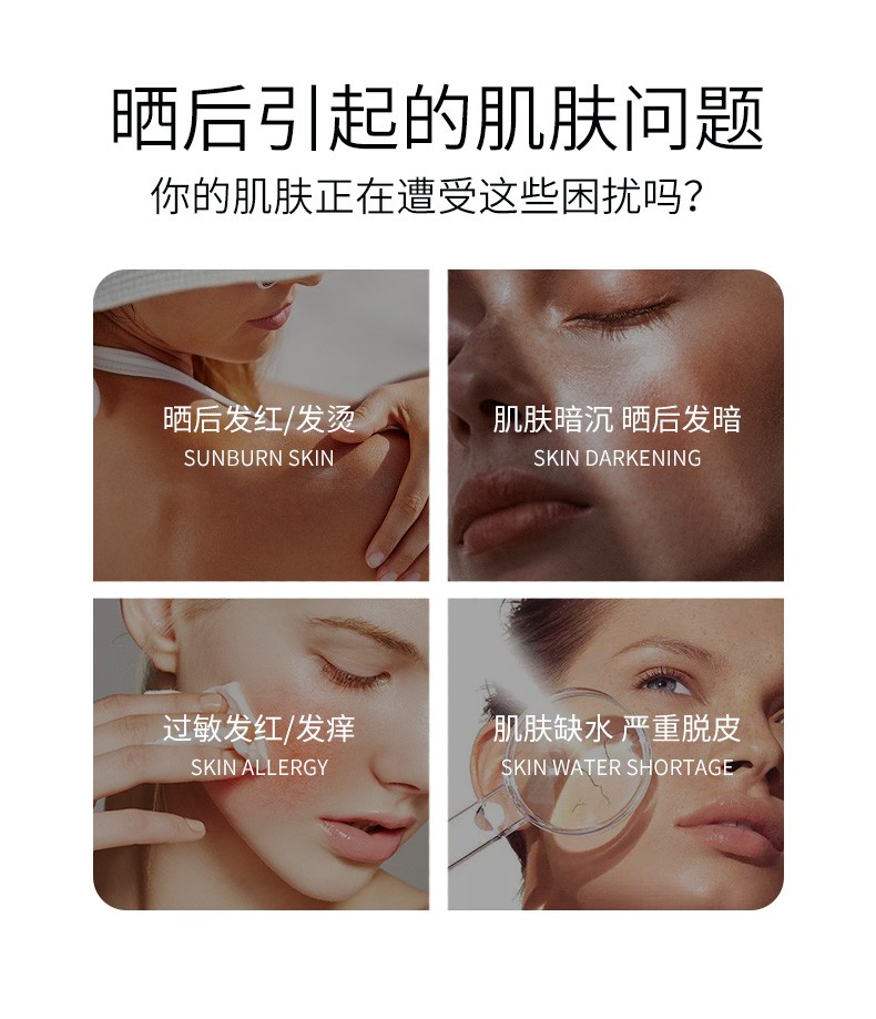 百肤邦 晒伤晒后修复膏喷雾2.0 缓解泛红脱皮改善晒黑户外运动军训 晒后膏+喷雾组合