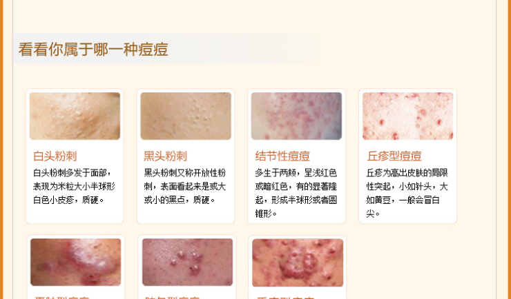 老中医祛痘精华修护素 30g 疏通毛囊 软化痘印