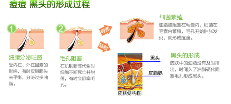 龙井秀 绿茶控油清爽泥浆面膜125g 祛痘祛黑头