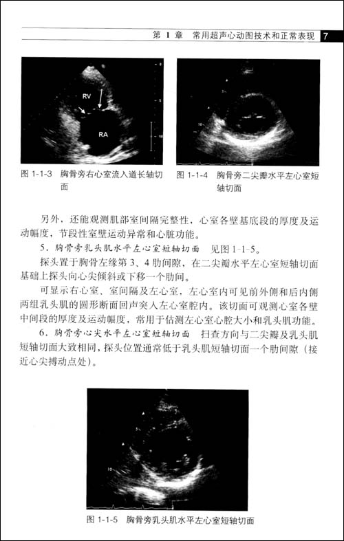 探头示标朝左上置于心尖搏动点,声束向上指向患者右肩胛部,扫查