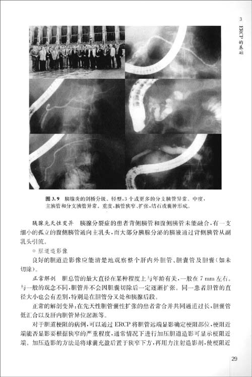 比如乳头括约肌功能障碍或乳头狭窄,这时拍片应使患者采取右侧卧位