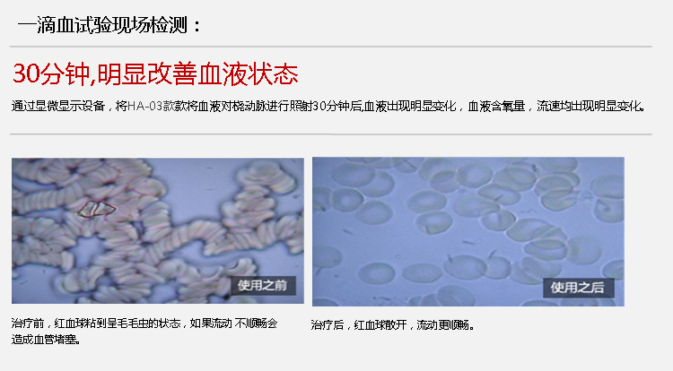 百家益腕表式半导体激光治疗仪HY-04T型 手表