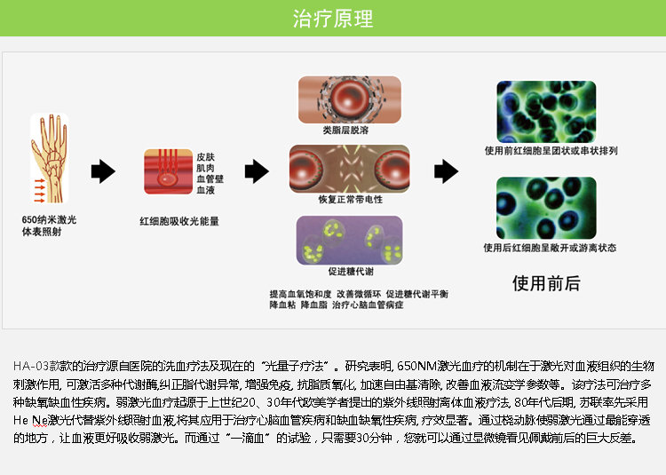 百家益腕表式半导体激光治疗仪HY-04T型 手表