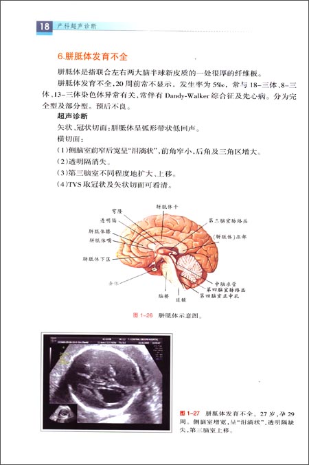 (1)自1980年kleinman等首次将超声心动图用于检测胎儿心脏以来