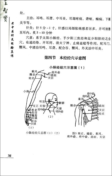 针灸对本病有很好的疗效.