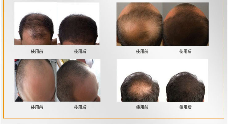 知医堂止脱生发发根活素 防脱发 止脱生发 促进