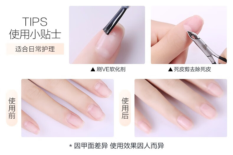 糖果小姐（Miss Candy） 健康指甲油  可撕拉 无刺激性气味美甲套装 底油亮油套装 SC215蛋白强韧护甲底油+快干高亮油+牛油果精华