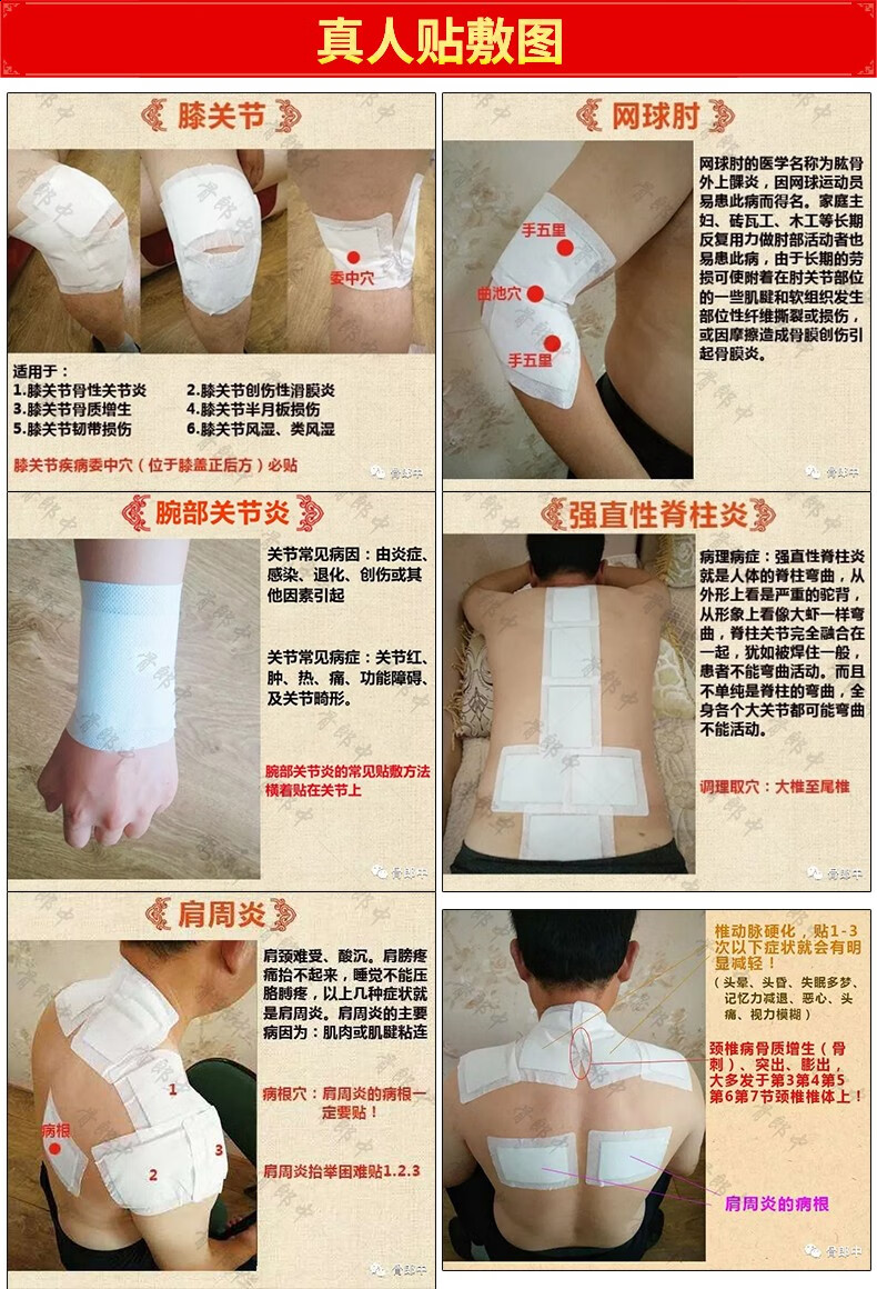 见证奇迹 骨郎中腰间盘突出膏药足跟痛颈椎病骨质膝盖