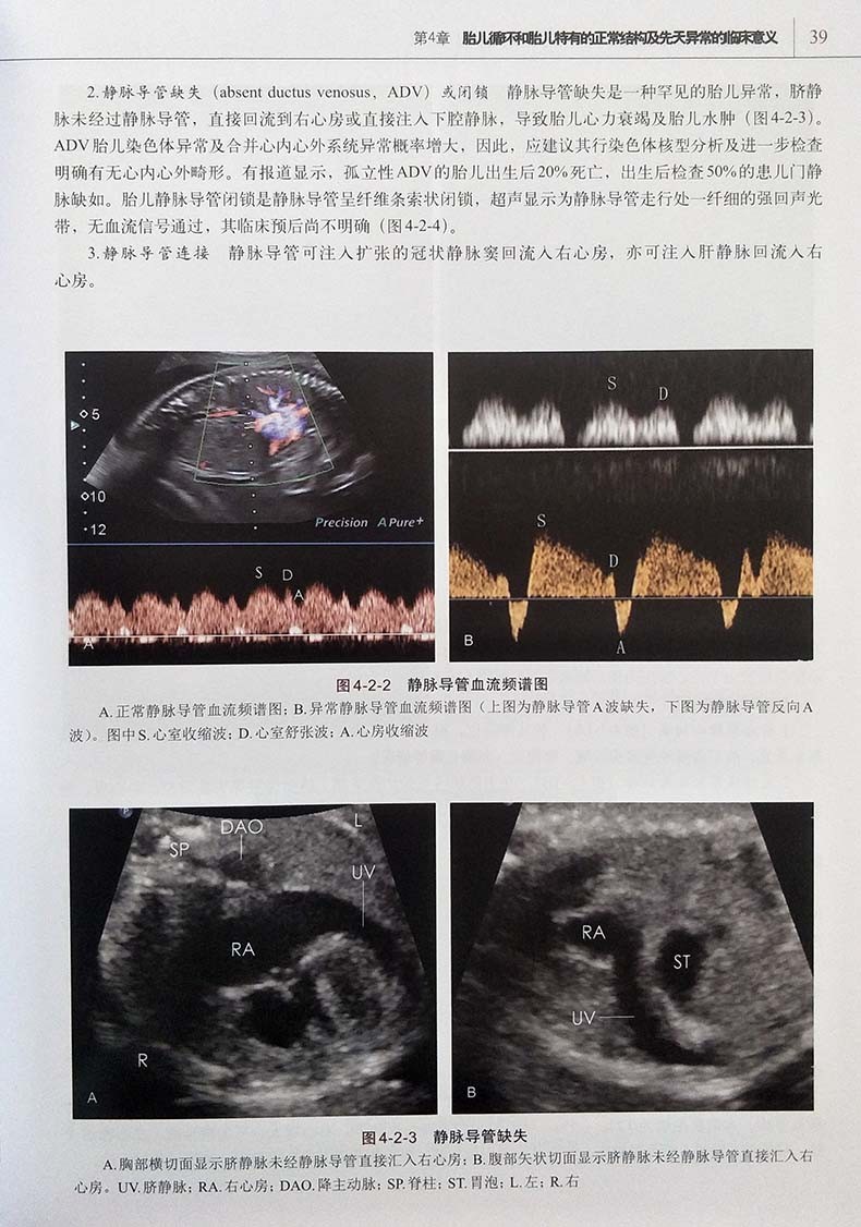 胎儿超声心动图学教程 李胜利 临床医学书籍