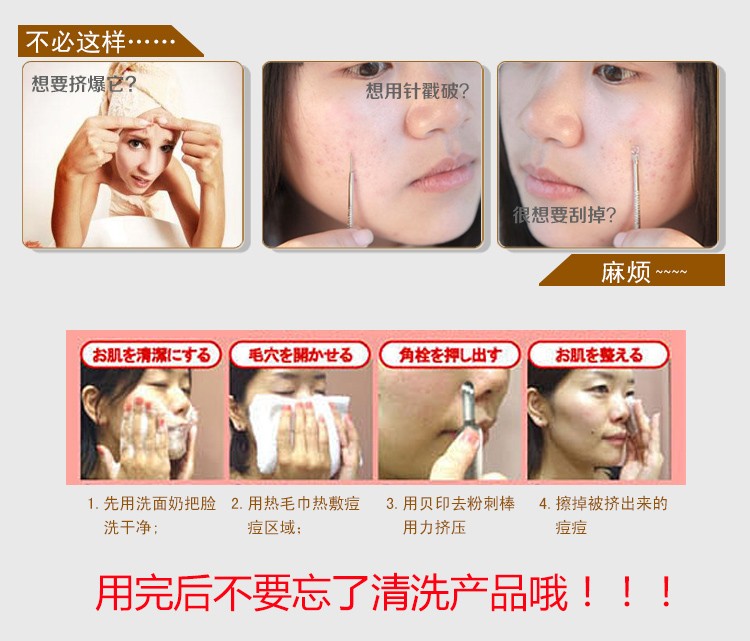 Kai贝印日本进口祛痘棒暗疮粉刺针不锈钢双头去黑头工具挑痘棒挤压棒kq 0971 图片价格品牌报价 京东