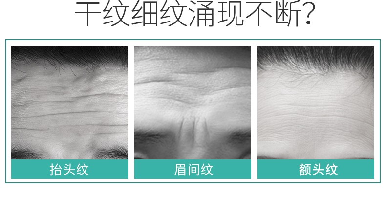 ILISYA【进口原料】抬头纹贴额头抗皱贴淡化川字纹法令纹男女通用面膜女 1盒装