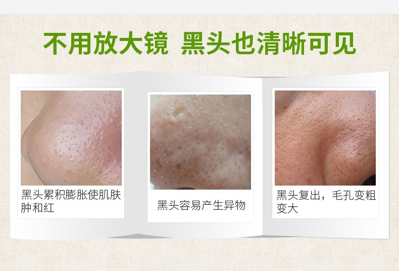 碧雅漫竹炭去黑头面膜60g 撕拉式鼻膜鼻子贴男女士 去粉刺收缩毛孔去角质去黑头去白头控痘鼻膜补水面膜 竹炭吸黑头面膜60gX2支