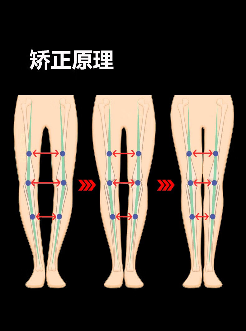 红吉花o型腿矫正器腿部矫正带绑腿带成人儿童男女式x型腿神器o腿型
