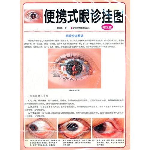 然后介绍各种疾病在眼睛上的反映,最后介绍了各种疾病眼像的实例