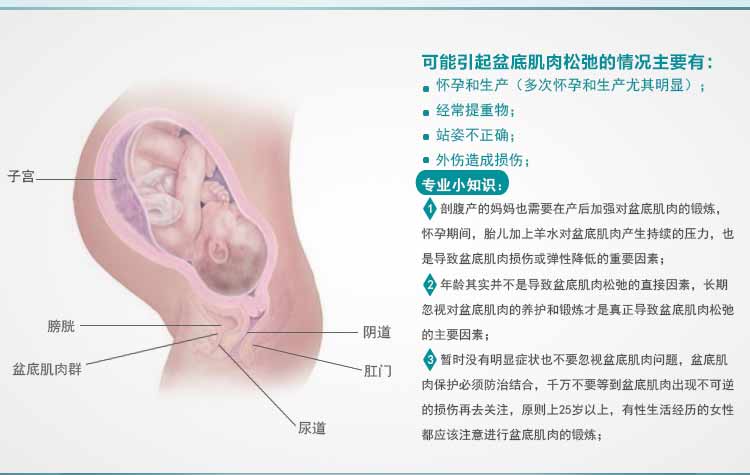 Neen便失禁前列腺阴道壁膨出盆底肌康复训练