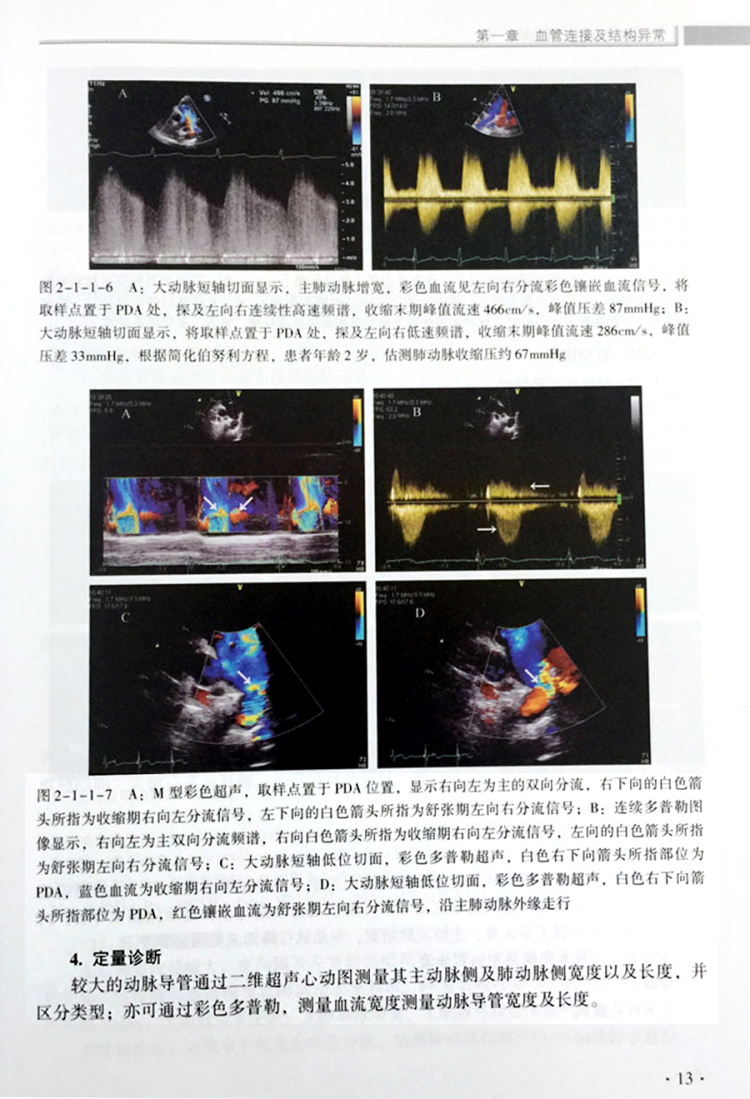 阜外医院心血管超声模板 王浩 9787506786010