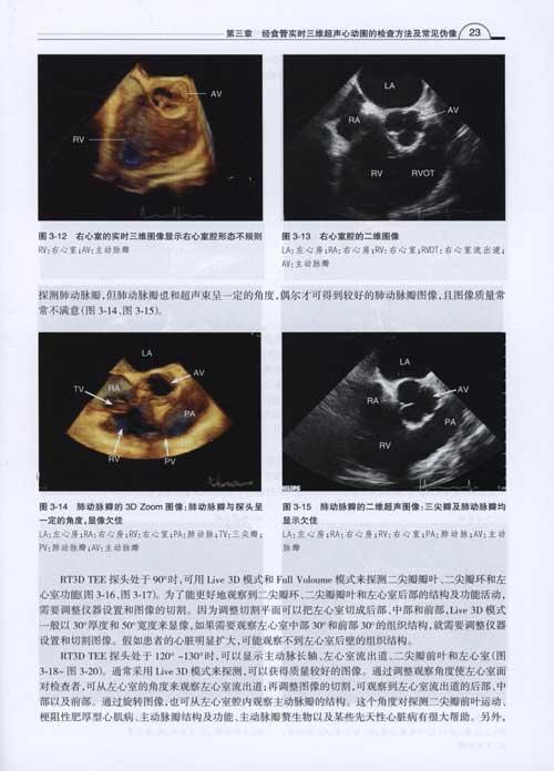 经食管实时3维超声心动图图谱 医学 书籍