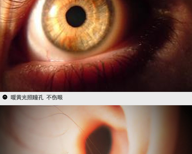 led瞳孔笔灯医用手电黄光医疗小手电筒