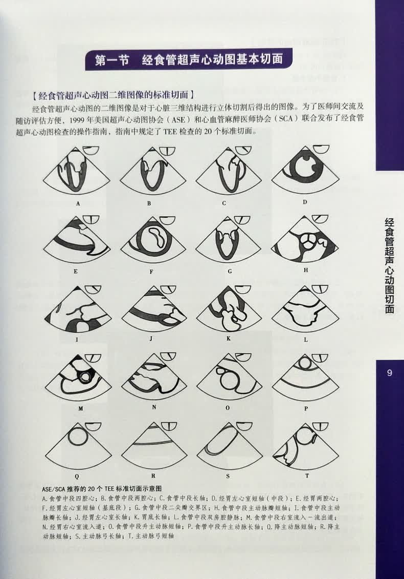 医学 基础医学 致仕(zisiz) 术中经食管超声心动图人卫版 马小静 何