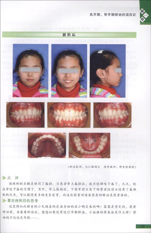 牙颌畸形矫治的适应证.病例展示邵金陵