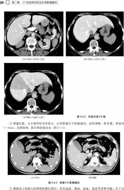 影像读片从入门到精通系列--ct读片指南(二版)